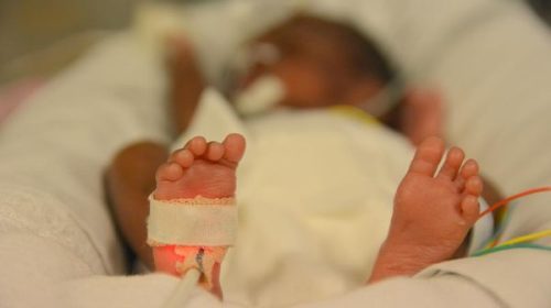 La mortalité infantile est deux fois plus importante dans les Outre-mer que dans l'Hexagone
